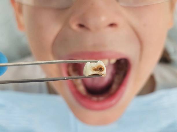 Best Dentist for Dental Trauma  in Woodland Beach, MI